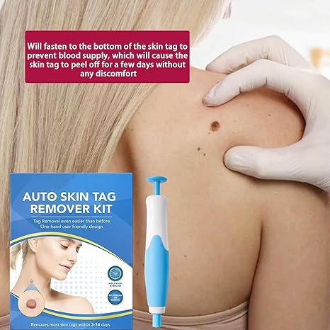 Acrochordon Skin Remover Kit My Store