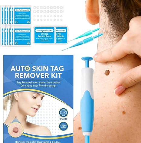 Acrochordon Skin Remover Kit My Store