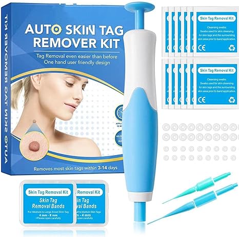 Acrochordon Skin Remover Kit My Store
