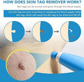 Acrochordon Skin Remover Kit My Store