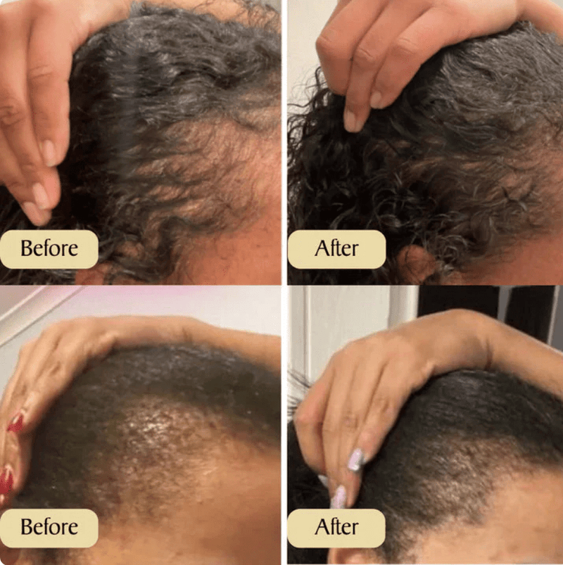 Hair Growth Oil Souq Rukna Al Khaleej